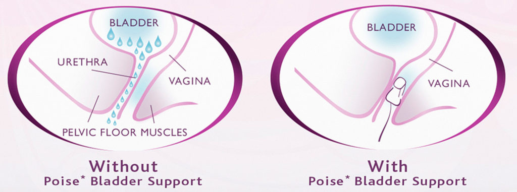 Impressa Vaginal Insert